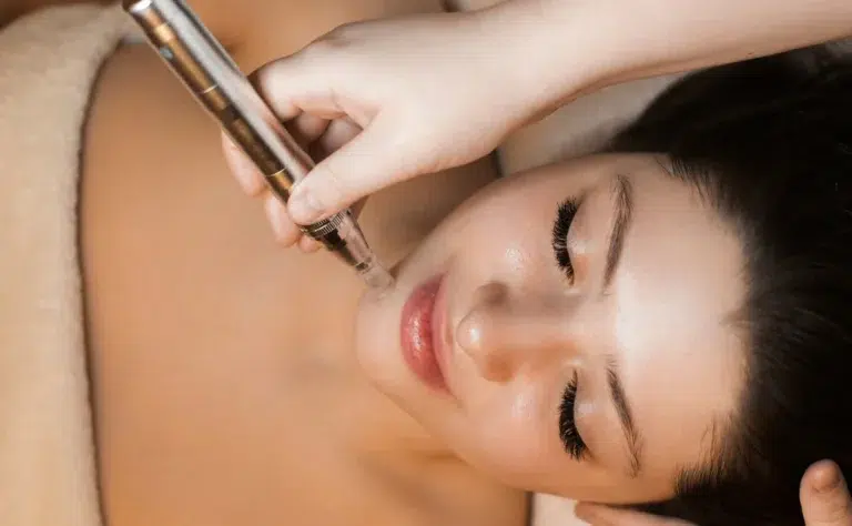 Comprehensive Microneedling Aftercare Guide