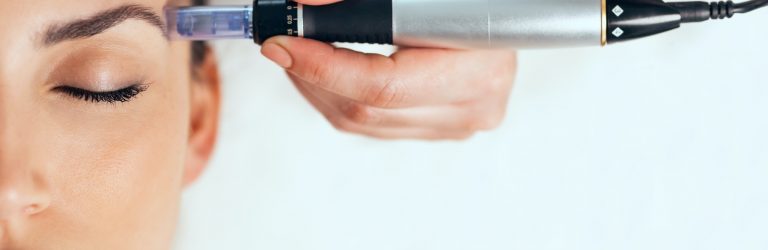 Mesotherapy Microneedling Treatment with SkinPen in Surrey Mesotherapy Microneedling Treatment with SkinPen in Surrey