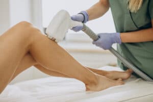 laser hair removal Surrey